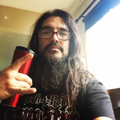 Операция Робба Флинна прошла успешно